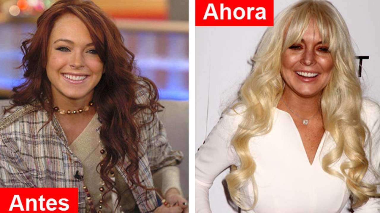 portada Linsay Lohan - Qué te paso Lindsay Lohan? Mira la foto!